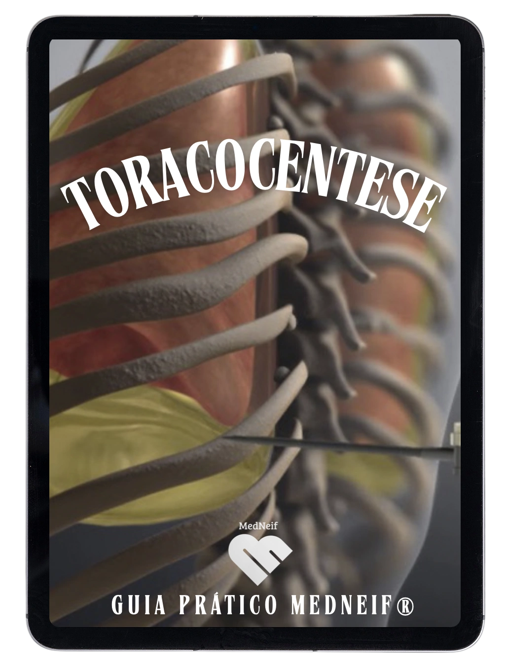 Guia Prático de Toracocentese